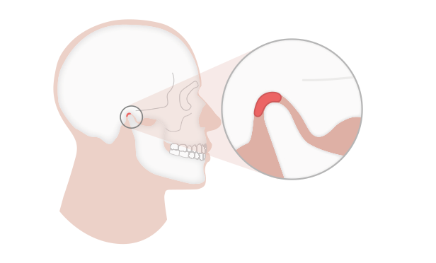 Kiefergelenk in zentrischer Position